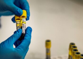 HIV could infect 1,400 infants every day because of US aid disruptions