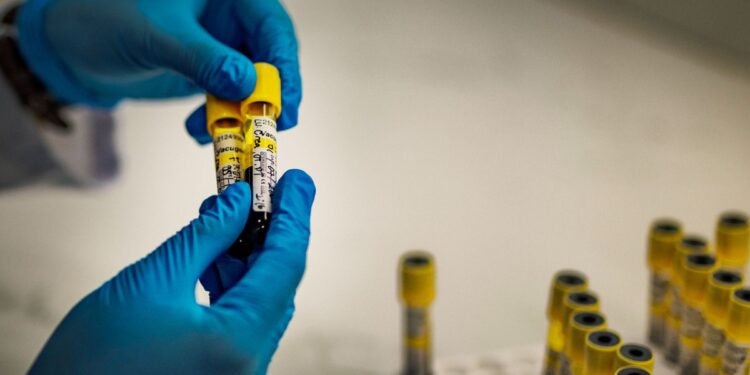 HIV could infect 1,400 infants every day because of US aid disruptions