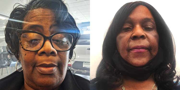 65-year-old furloughed by government shutdown: ‘I could lose the house. I could lose my car. I could lose everything’