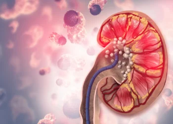 Why drinking more water didn’t prevent kidney stones